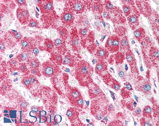 Anti-CLPP antibody IHC of human liver. Immunohistochemistry of formalin-fixed, paraffin-embedded tissue after heat-induced antigen retrieval. Antibody LS-B2749 concentration 5 ug/ml.