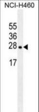 EIF4E2 antibody western blot of NCI-H460 cell line lysates (35 ug/lane). The EIF4E2 antibody detected the EIF4E2 protein (arrow).