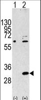 Western blot of EIF4E2 Antibody polyclonal antibody(arrow). 293 cell lysates (2 ug/lane) either nontransfected (Lane 1) or transiently transfected with the EIF4E2 gene (Lane 2) (Origene Technologies).
