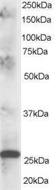 Antibody staining (1 ug/ml) of human muscle lysate (RIPA buffer, 35 ug total protein per lane). Primary incubated for 1 hour. Detected by Western blot of chemiluminescence.