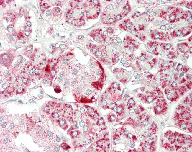 Human Pancreas: Formalin-Fixed, Paraffin-Embedded (FFPE)