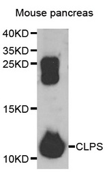 Western blot analysis of extracts of mouse pancreas, using CLPS antibody.
