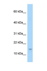 EIF4EBP1 / 4EBP1 antibody LS-C146341 Western blot of Mouse Heart lysate. Antibody concentration 1 ug/ml.