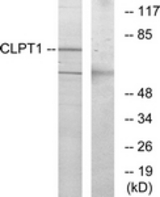 Western blot of extracts from COS7 cells, using CLPT1 Antibody. The lane on the right is treated with the synthesized peptide.