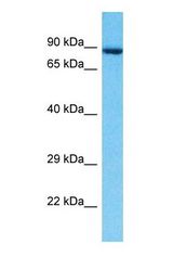 Western blot of CLPTM1 Antibody with human MCF7 Whole Cell lysate.