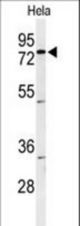 Western blot of CLPTM1 Antibody in HeLa cell line lysates (35 ug/lane). CLPTM1 (arrow) was detected using the purified antibody.