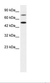 Jurkat Cell Lysate