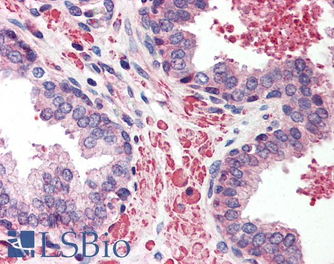 Anti-EIF4EBP1 / 4EBP1 antibody IHC of human prostate. Immunohistochemistry of formalin-fixed, paraffin-embedded tissue after heat-induced antigen retrieval. Antibody LS-B564 concentration 5 ug/ml.