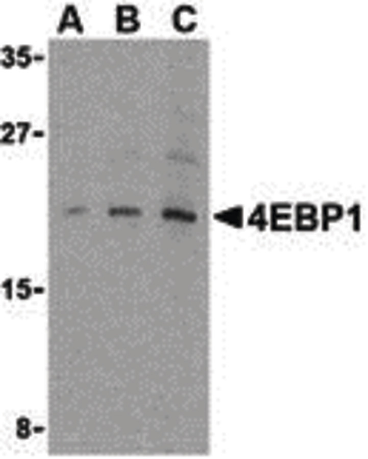Western blot of 4E-BP1 in 3T3 cell lysate with 4E-BP1 antibody at (A) 2.5, (B) 5 and (C) 10 ug/ml.