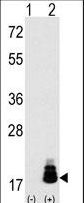 Western blot of EIF4EBP1 (arrow) using rabbit polyclonal EIF4EBP1 Antibody (T69) (RB11407). 293 cell lysates (2 ug/lane) either nontransfected (Lane 1) or transiently transfected with the EIF4EBP1 gene (Lane 2) (Origene Technologies).