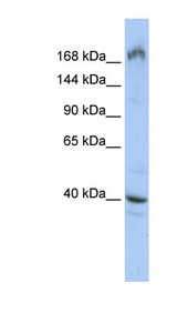 EIF4G1 antibody LS-C110537 Western blot of HepG2 cell lysate.