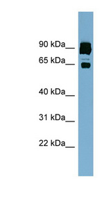 CLPTM1L antibody LS-C107967 Western blot of ACHN lysate.