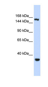 EIF4G3 antibody LS-C101849 Western blot of HeLa lysate.