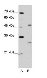 A: Marker, B: Jurkat Cell Lysate