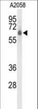 Western blot of CLPTM1L Antibody in A2058 cell line lysates (35 ug/lane). CLPTM1L (arrow) was detected using the purified antibody.