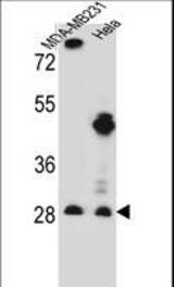 EIF4H Antibody western blot of MDA-MB231,HeLa cell line lysates (35 ug/lane). The EIF4H antibody detected the EIF4H protein (arrow).