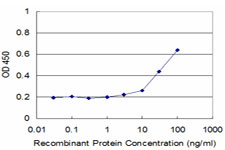 Detection limit for recombinant GST tagged WBSCR1 is approximately 3 ng/ml as a capture antibody.