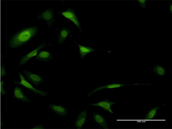 Immunofluorescence of monoclonal antibody to EIF5A on HeLa cell . [antibody concentration 10 ug/ml]