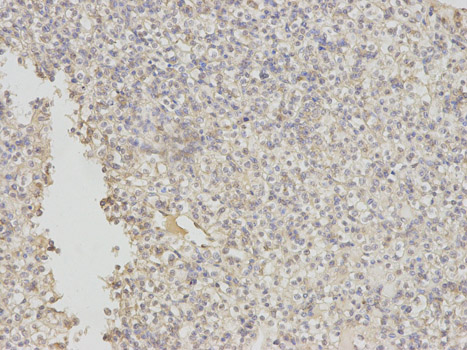 Immunohistochemistry of paraffin-embedded human liver using EIF5A antibody at dilution of 1:200 (200x lens).