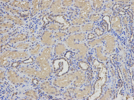 Immunohistochemistry of paraffin-embedded human kidney using EIF5A antibody at dilution of 1:200 (200x lens).