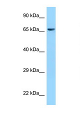 CLPX antibody LS-C146170 Western blot of 293T Cell lysate. Antibody concentration 1 ug/ml.