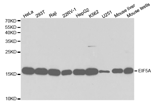 Western blot analysis of extracts of various cell lines, using EIF5A antibody.