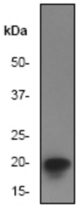 Western blot analysis on Jurkat cell lysates using anti-eIF-5A antibody, 1:1000 dilution.