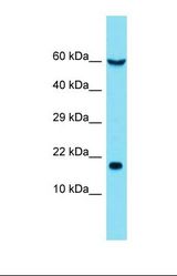 Western blot of Human NCI-H226. EIF5A antibody dilution 1.0 ug/ml.