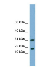 EIF5A2 antibody LS-C112053 Western blot of Fetal Liver lysate.