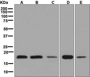Western blot analysis on (A) 293T, (B) HeLa, (C) A431, (D) Caco-2, and (E) HepG2 cell lysates using anti-eIF5A2 antibody.