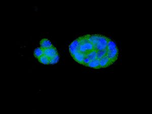 Immunofluorescent staining of HepG2 cells using anti-eIF5A2 antibody.