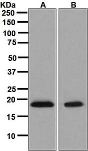 Western blot analysis on (A) HepG2 and (B) Caco-2 cell lysates using anti-eIF5A2 antibody.