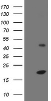 HEK293T cells were transfected with the pCMV6-ENTRY control (Left lane) or pCMV6-ENTRY EIF5A2 (Right lane) cDNA for 48 hrs and lysed. Equivalent amounts of cell lysates (5 ug per lane) were separated by SDS-PAGE and immunoblotted with anti-EIF5A2.