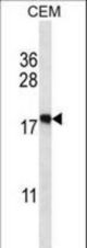 EIF5A2 Antibody western blot of CEM cell line lysates (35 ug/lane). The EIF5A2 antibody detected the EIF5A2 protein (arrow).