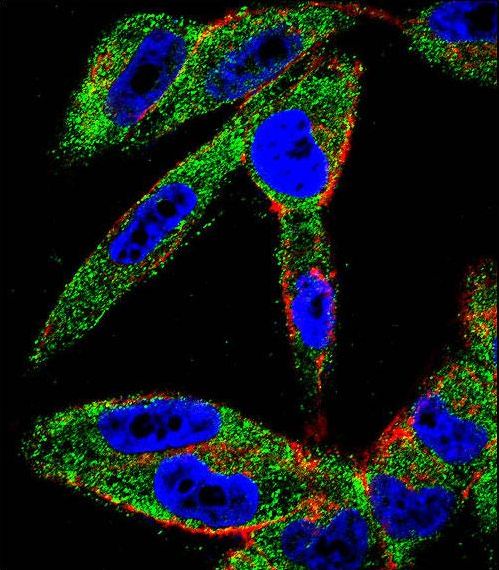 Confocal immunofluorescent of EIF5AL1 Antibody with A2058 cell followed by Alexa Fluor 488-conjugated goat anti-rabbit lgG (green). Actin filaments have been labeled with Alexa Fluor 555 phalloidin (red). DAPI was used to stain the cell nuclear (blue).