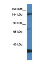 EIF5B antibody LS-C145468 Western blot of Jurkat Cell lysate. Antibody concentration 1 ug/ml.