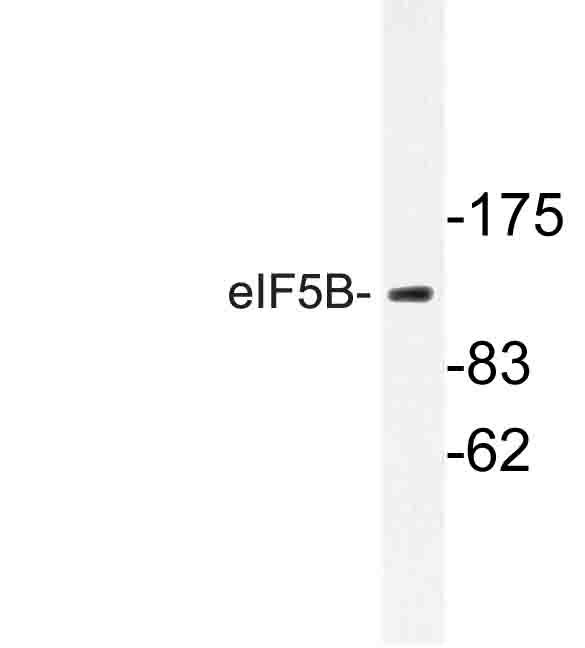 Western blot of eIF5B (H1086) pAb in extracts from Jurkat cells.
