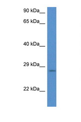 EIF6 / ITGB4BP antibody LS-C145397 Western blot of HeLa Cell lysate. Antibody concentration 1 ug/ml.