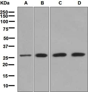 Western blot analysis on (A) HeLa, (B) 293T, (C) HepG2, and (D) K562 cell lysates using anti-ITGB4BP antibody.