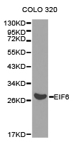 Western blot of extracts of COLO 320 cell lines, using EIF6 antibody.
