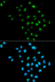 Immunofluorescence analysis of MCF7 cell using EIF6 antibody. Blue: DAPI for nuclear staining.