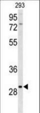 Western blot of CLRN3 Antibody in 293 cell line lysates (35 ug/lane). CLRN3 (arrow) was detected using the purified antibody.