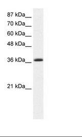 K562 Cell Lysate