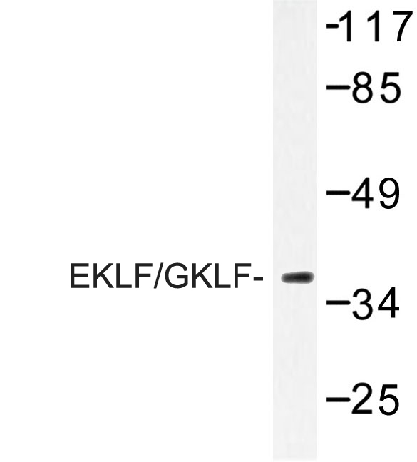 Western blot of EKLF/GKLF (W318) pAb in extracts from Jurkat cell treated with serum 20% 15'.
