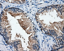 IHC of paraffin-embedded prostate tissue using anti-ELAVL1 mouse monoclonal antibody. (Dilution 1:50).