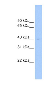 ELAVL2 / HuB antibody LS-C116177 Western blot of Fetal Brain lysate.
