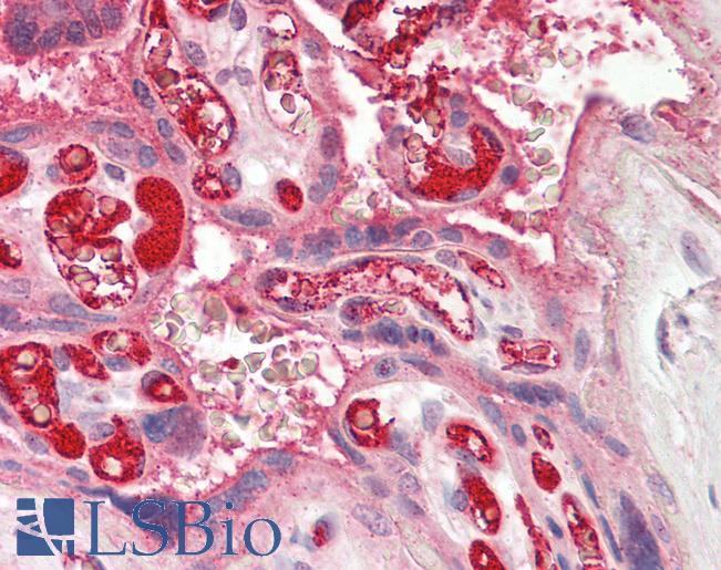 Anti-CHML antibody IHC of human placenta. Immunohistochemistry of formalin-fixed, paraffin-embedded tissue after heat-induced antigen retrieval. Antibody LS-B8583 dilution 5 ug/ml.