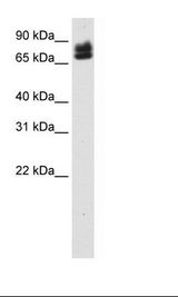SP2/0 Cell Lysate