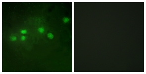 Immunofluorescence of A549 cells, using ELF1 Antibody. The picture on the right is treated with the synthesized peptide.