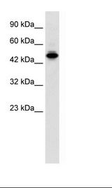 Jurkat Cell Lysate